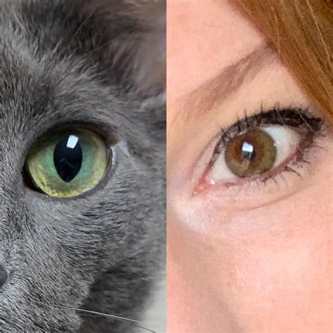 My Cat And I Both Have Central Heterochromia But In Different Color