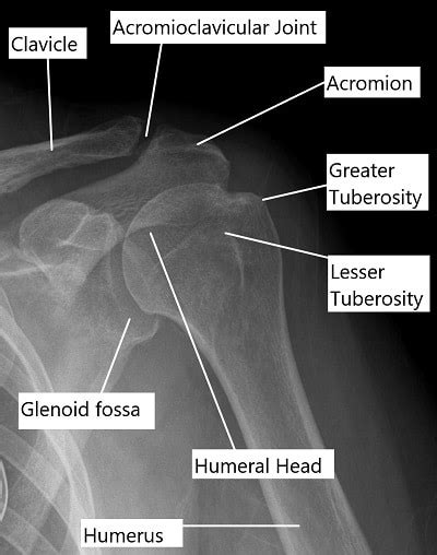 Ac Joint Pain Complete Orthopedics Multiple Ny Locations