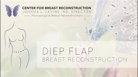Diep Flap Breast Reconstruction Guided Illustration By Dr Joshua L