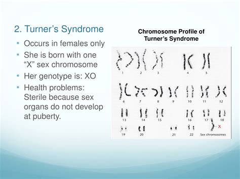 Ppt Chromosomal Disorders Karyotyping Powerpoint Presentation Free