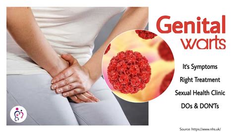 Symptoms Of Genital Warts Cure For Genital Warts How To Know If You Have Genital Warts