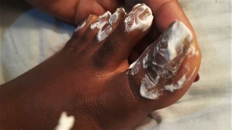 Asmr Toenails Cleaning Nail Keratin Debris Up Closeroadto1000subs