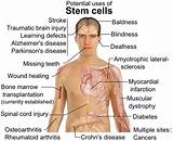 Stem Cell Treatment For Hair Loss Side Effects