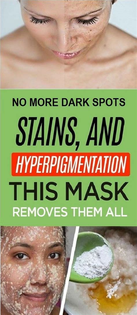 No More Dark Spots Stains And Hyperpigmentation This Mask Removes