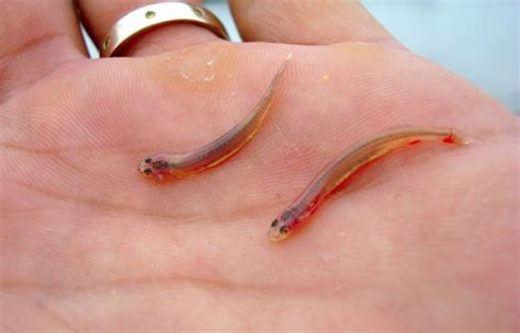 10 Most Terrifying Parasites That Can Live In The Human Body Pictolic