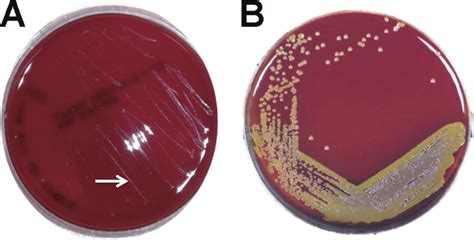 Used to specifically grow gram positive organisms such as staphylococci, streptococci and enterococci. Small colony variants compared with normal colonies. (A ...