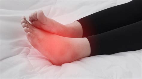 Anda ada masalah lutut bengkak akibat serangan gout? 5 Tanda Awal Penyakit Kronik - Oh! Media