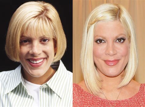 Tori Spelling From Celebs Whove Admitted To Getting Plastic Surgery