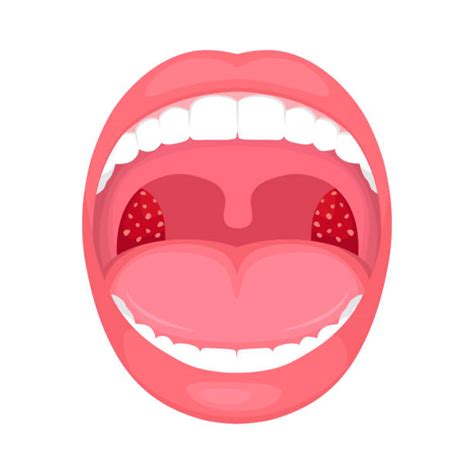 Best Tonsils Illustrations Royalty Free Vector Graphics And Clip Art