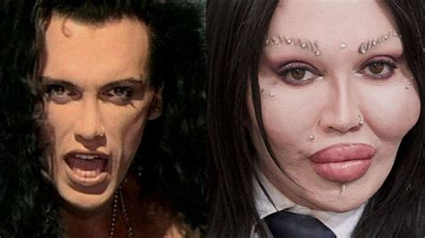 Pete Burns Plastic Surgery How Was The Singer When He Was Young Was