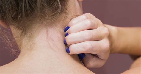 Itchy Neck Causes Remedies And Prevention