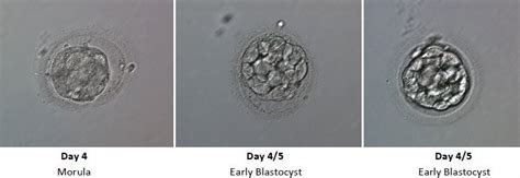 Embryo Development In Ivf Wilcox Fertility Pasadena Fertility Doctor