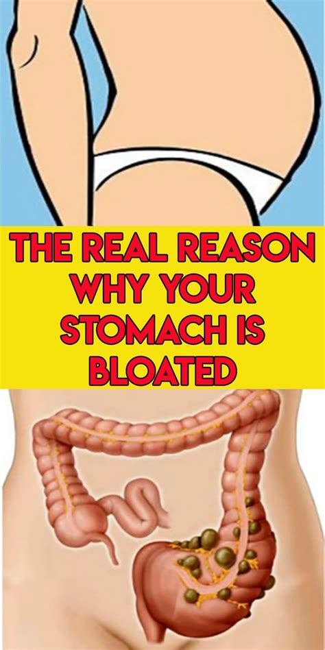 How To Fix Bloated Stomach And Real Reasons Why Is Bloated Bloated Stomach Stomach Remedies