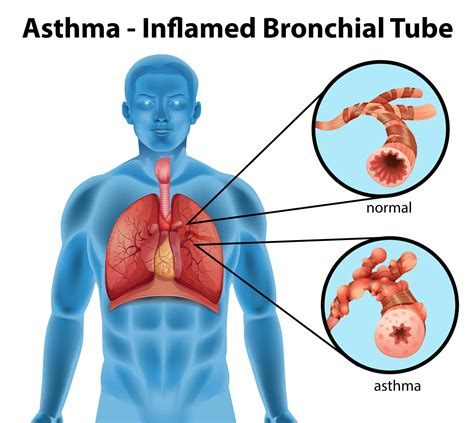 Can Essential Oils Be Used For Asthma Treatment Essential Oil Benefits