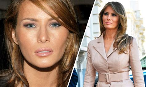 Cosmetic Doctor Reveals How British Women Can Recreate Melania Trumps