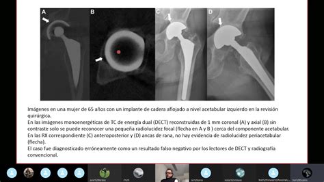 Simple Science: How to Make a Volcano with Kids
