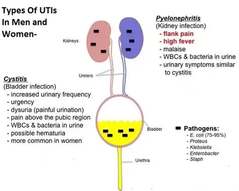 How To Permanently Cure Urinary Tract Infection Quora