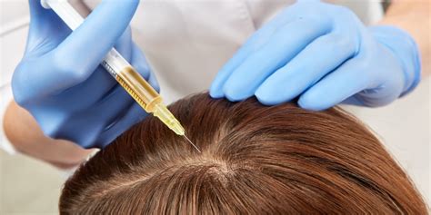 Another study, conducted in 2013, focused on 11 men with male pattern baldness (also known as. PRP Hair Loss Treatment At Dr. Richa's Unique Clinic, we ...