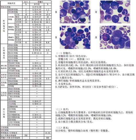 慢性粒细胞白血病一例分析临床实验室期刊文章检验视界网