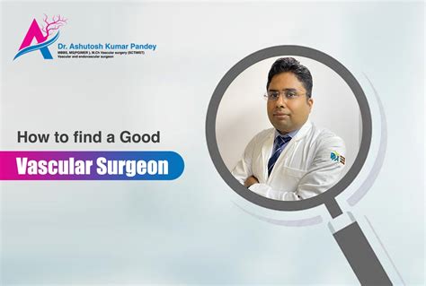 How To Find A Good Vascular Surgeon