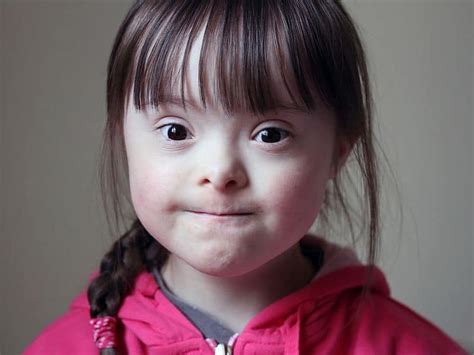 Gestational Age Tied To Attention Deficit Symptoms With Down Syndrome Physicians Weekly