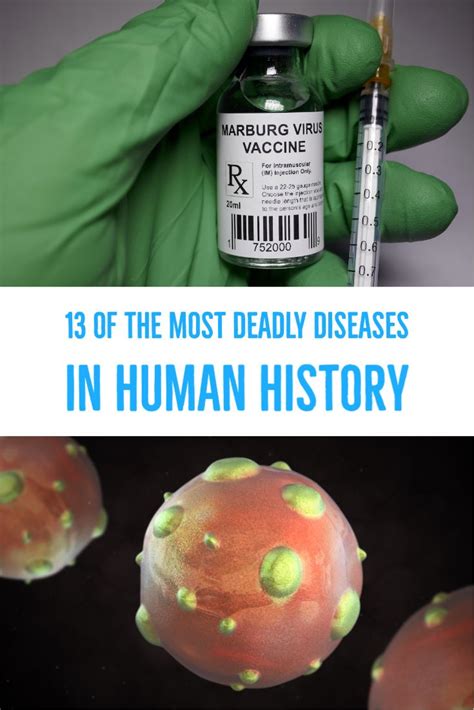 13 Of The Most Deadly Diseases In Human History Disease History Human