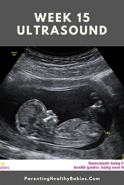 15 Week Baby Bump Mrshazleyandababy August 2013 All Ultrasound