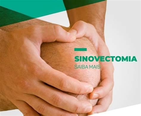 Sinovectomia O Que é Pacientes Do Dr Márcio Silveira Ortopedista
