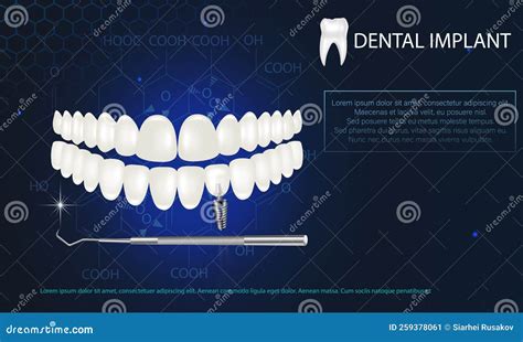 Implante Dental Blanco Realista Sobre Un Fondo Azul Modelo Vectorial