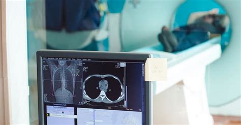Rezonans magnetyczny klatki piersiowej - na czym polega i kiedy go wykonać?