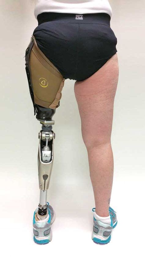 260 Prosthetic Leg Ideas In 2021 Prosthetic Leg Amputee Prosthetics