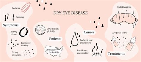 What Is Dry Eye Disease Corneacare Eyecare Made Easy