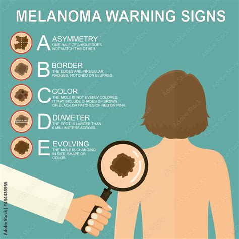 diagnosis of skin cancer melanoma warning signs dermatological screening uvb prevention of