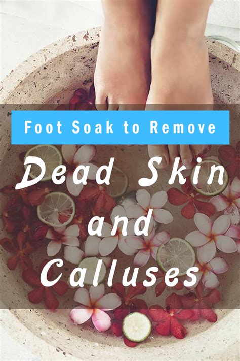 10 Best Foot Soaks To Remove Dead Skin And Calluses Homemade Foot Soak Diy Foot Soak Foot