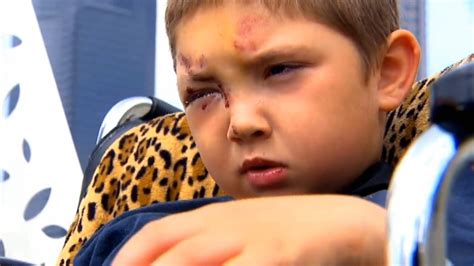 6 year old beaten after standing up to bullies fox news video