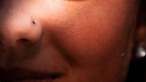 Keloid On Inside Of Nose Piercing What You Need To Know Flash Uganda Media