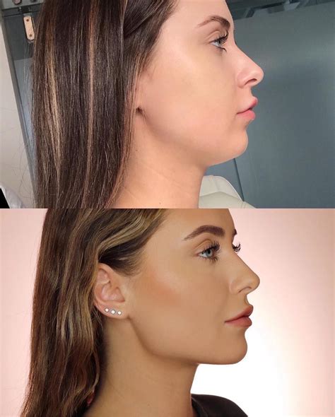 Skin By Lovely On Instagram Repost From Kristinaxmakeup Side Profile Snatched So Hard