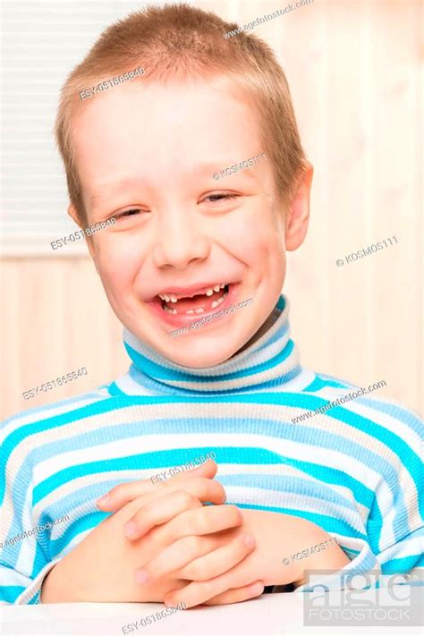Happy 6 Year Old Boy With Milk Teeth Dropped Out Front Stock Photo