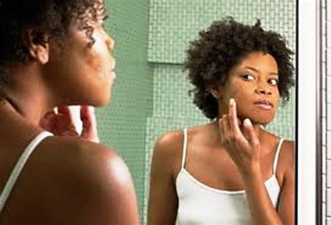 How much you make has little to do with how much you get back. Adult Acne. How Do You Deal? | Afrobella