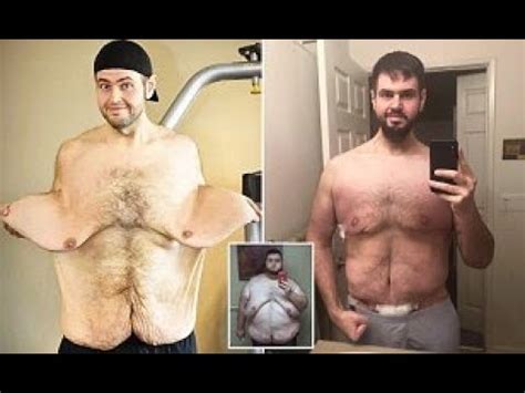 Morbidly Obese Man Shows Off His Incredible Lbs Weight Loss Smiling Studio YouTube