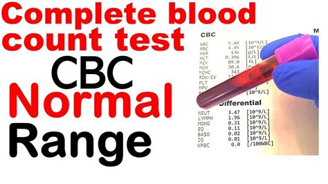 Complete Blood Count Or CBC Test Normal Range YouTube