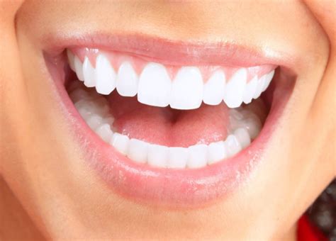 Can You Whiten Your Teeth While Wearing Braces