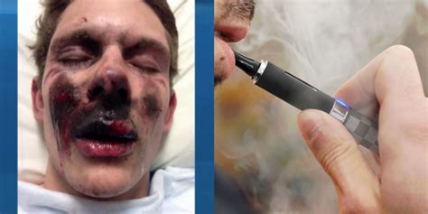 E cig brands that have exploded. Vaping. It's a legitimate cessation, with many people ...