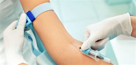 Exame Tsh Ultra Sens Vel Como Coletar O Sangue Jejum Indicado Resultado Normal E Alterado Com