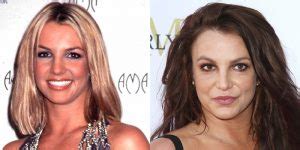 Has Britney Spears Had Plastic Surgery Face Before And After