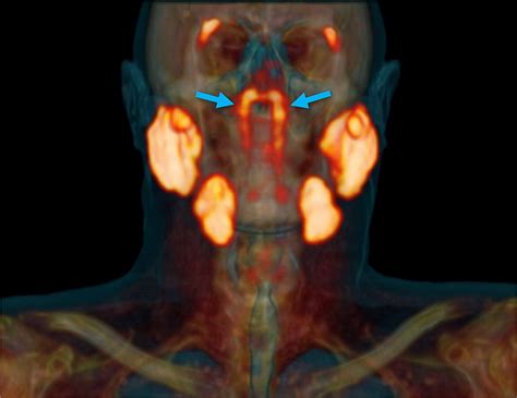 Anatomy Of A Discovery Exploring The Impact Of New Salivary Gland
