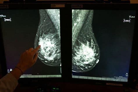 researchers identify possible new risk for breast cancer the new york times