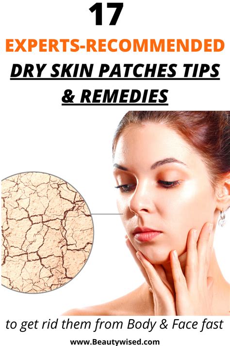 Pictures Of Dry Skin Patches On Back Goimages Base