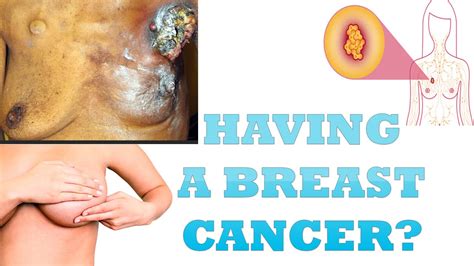 If they sound familiar, ask your gynecologist for a. Breast Cancer | How to know if you have Breast Cancer ...