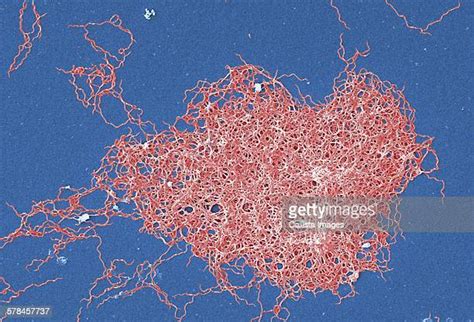 Anaerobic Bacteria Photos And Premium High Res Pictures Getty Images